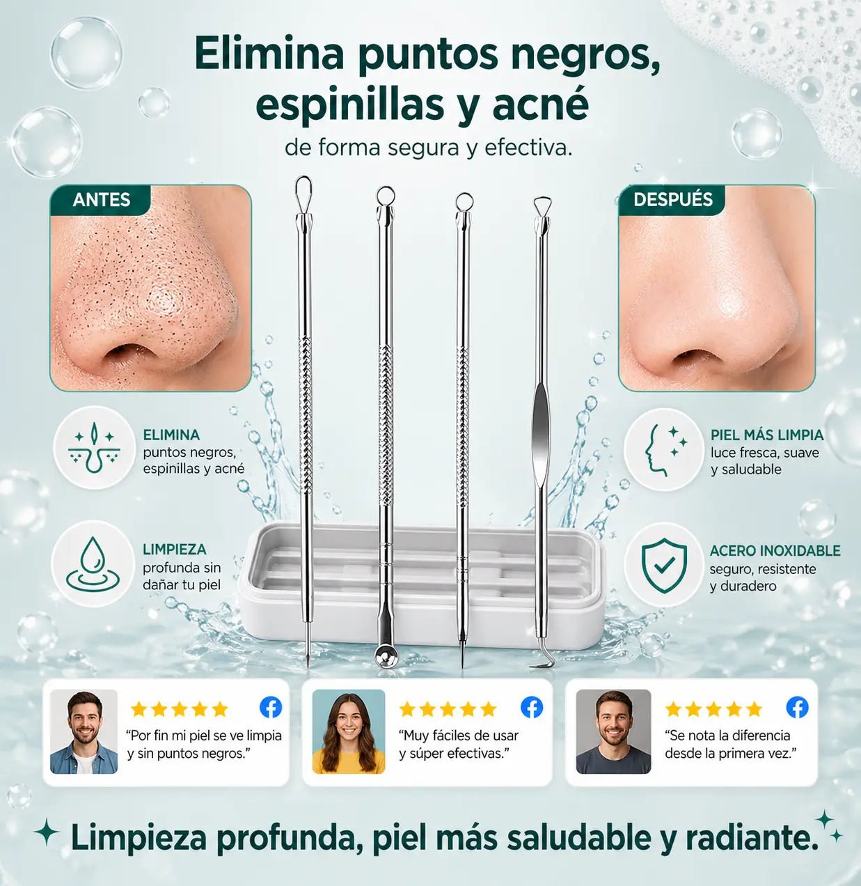 Kit para acné 4 en 1 - Todo lo que necesitas en un solo sistema