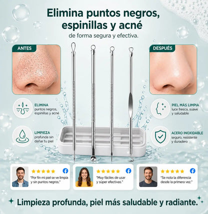 Kit para acné 4 en 1 - Todo lo que necesitas en un solo sistema